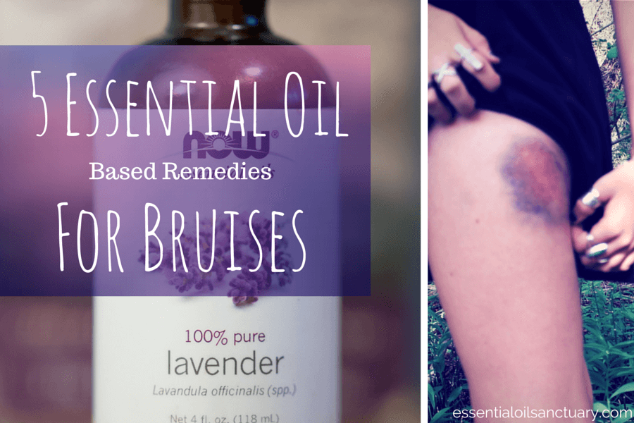 5 Essential Oil Remedies for Bruises