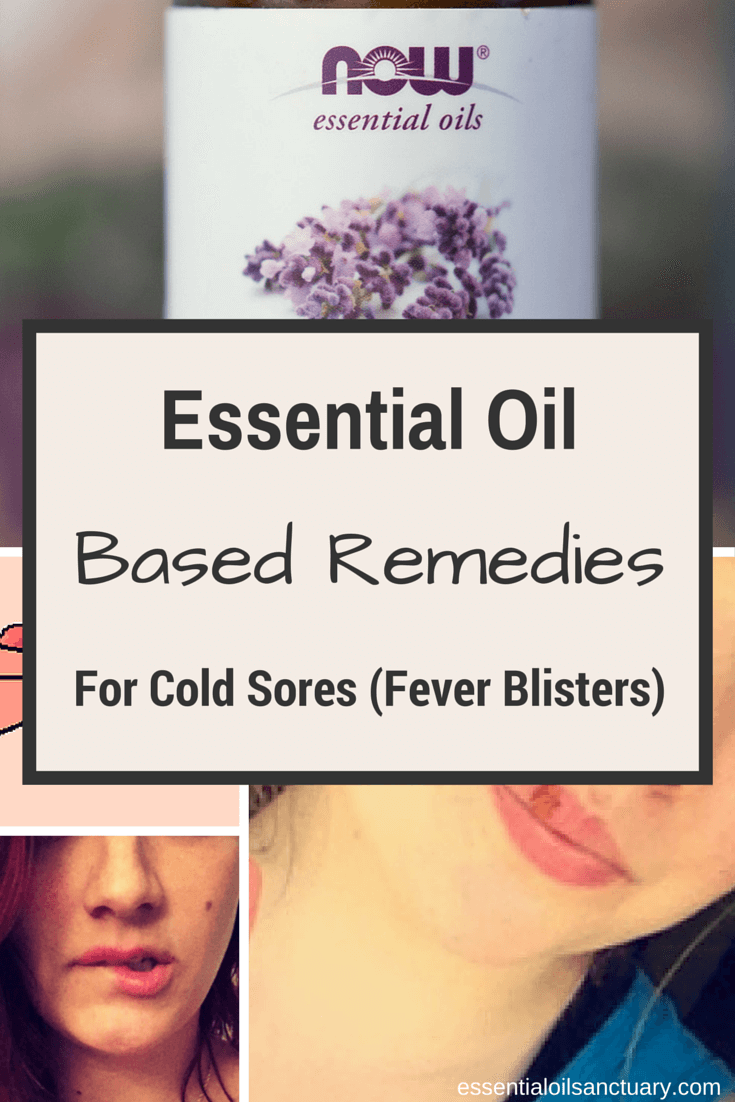 Essential Oil based remedies for cold sores fever blisters
