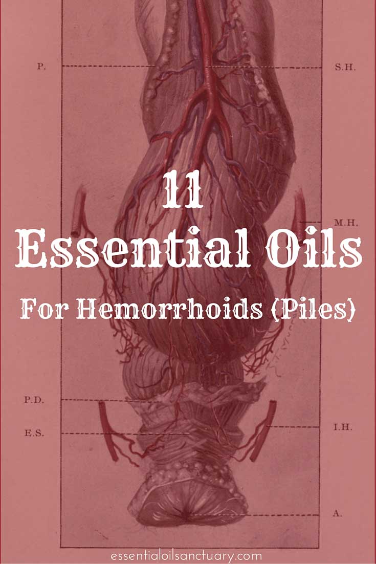 hemorrhoids piles essential oil